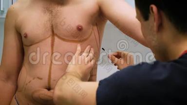 一位整形外科医生为吸脂和脂肪雕塑的手术画了一个标记。 病人是人，人`美